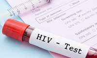 مشاوره و آزمایش داوطلبانه ۲۵ هزار نفر برای شناسایی اچ آی وی در همدان